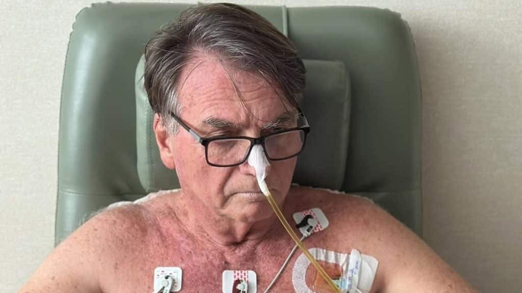 Bolsonaro: Recuperação "Acima do Esperado", Mas Sem Previsão de Alta da UTI